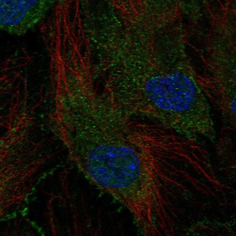 Immunocytochemistry/ Immunofluorescence - Anti-SCHIP1 antibody (AB247177)