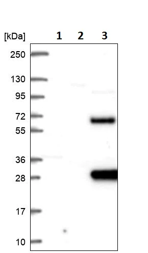 Western blot - Anti-SCHIP1 antibody (AB247177)