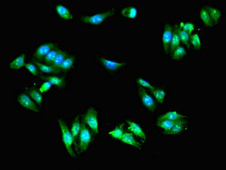 Immunocytochemistry/ Immunofluorescence - Anti-SCIN antibody (AB223055)
