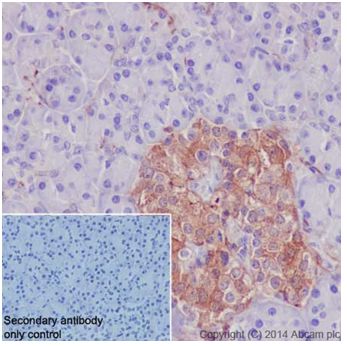 Immunohistochemistry (Formalin/PFA-fixed paraffin-embedded sections) - Anti-SCIN antibody [EPR16310] - C-terminal (AB199723), expandable thumbnail