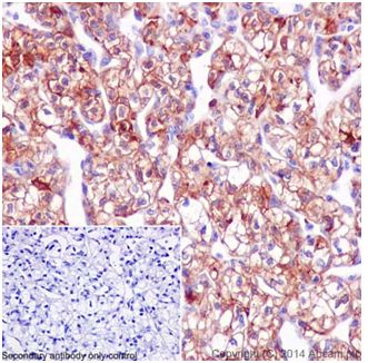 Immunohistochemistry (Formalin/PFA-fixed paraffin-embedded sections) - Anti-SCIN antibody [EPR16310] - C-terminal (AB199723), expandable thumbnail