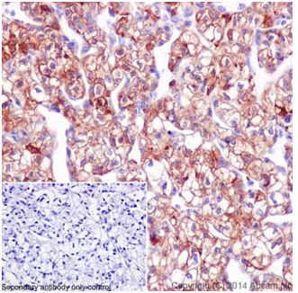 Immunohistochemistry (Formalin/PFA-fixed paraffin-embedded sections) - Anti-SCIN antibody [EPR16310] - C-terminal (AB199723)