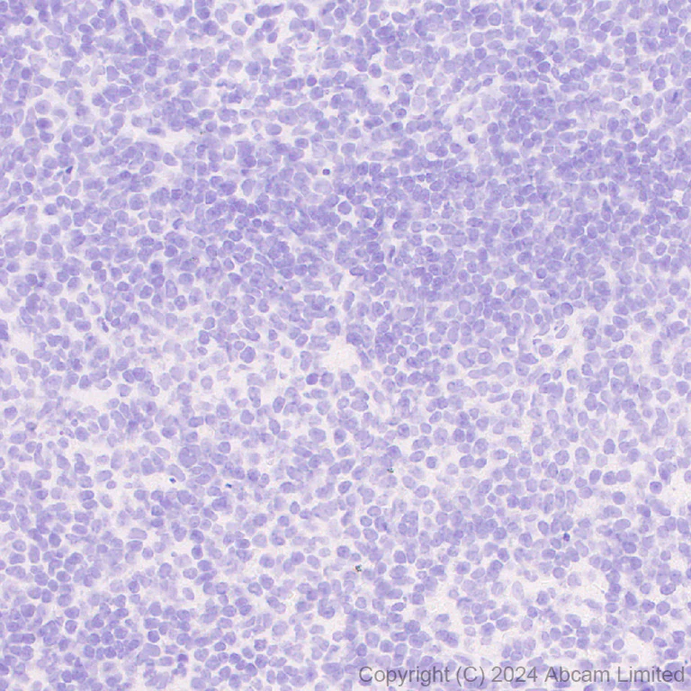 Immunohistochemistry (Formalin/PFA-fixed paraffin-embedded sections) - Anti-Sclerostin antibody [EPR28892-591] - BSA and Azide free (AB326597)