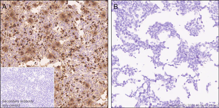 Immunohistochemistry (Formalin/PFA-fixed paraffin-embedded sections) - Anti-Sclerostin antibody[EPR28892-591] (AB322897)