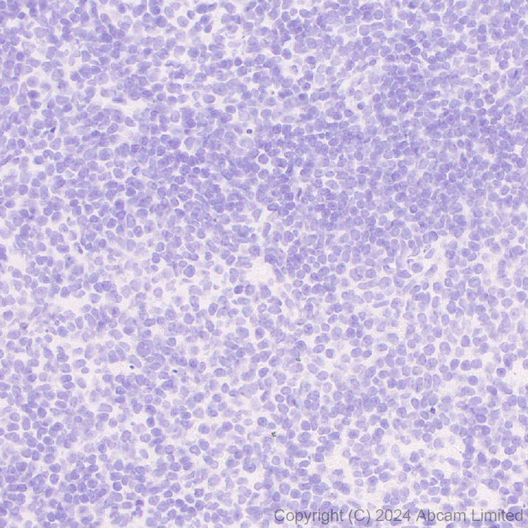 Immunohistochemistry (Formalin/PFA-fixed paraffin-embedded sections) - Anti-Sclerostin antibody[EPR28892-591] (AB322897)