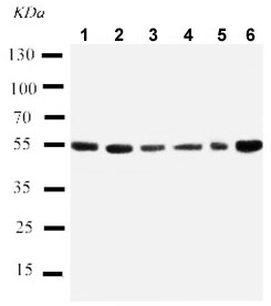 Western blot - Anti-SCLY antibody - C-terminal (AB190983)