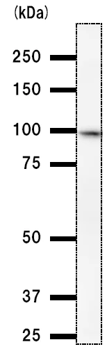 Western blot - Anti-SCML2 antibody [SCMAD14A] (AB51506)
