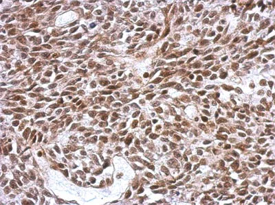 Immunohistochemistry (Formalin/PFA-fixed paraffin-embedded sections) - Anti-SCML4 antibody (AB154011)