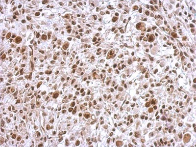 Immunohistochemistry (Formalin/PFA-fixed paraffin-embedded sections) - Anti-SCML4 antibody (AB154011), expandable thumbnail