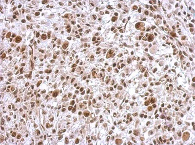 Immunohistochemistry (Formalin/PFA-fixed paraffin-embedded sections) - Anti-SCML4 antibody (AB154011)