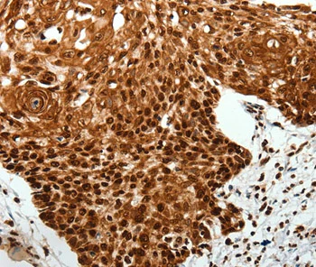 Immunohistochemistry (Formalin/PFA-fixed paraffin-embedded sections) - Anti-SCN11A antibody (AB198859)
