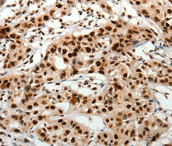 Immunohistochemistry (Formalin/PFA-fixed paraffin-embedded sections) - Anti-SCN11A antibody (AB198859)