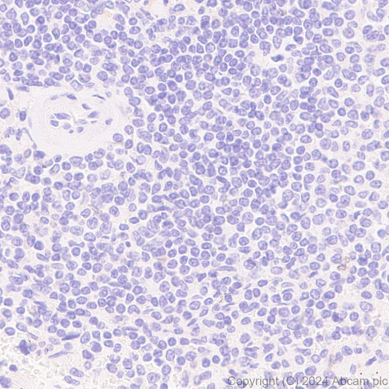 Immunohistochemistry (Formalin/PFA-fixed paraffin-embedded sections) - Anti-SCN11A antibody [EPR28603-86] (AB316326)