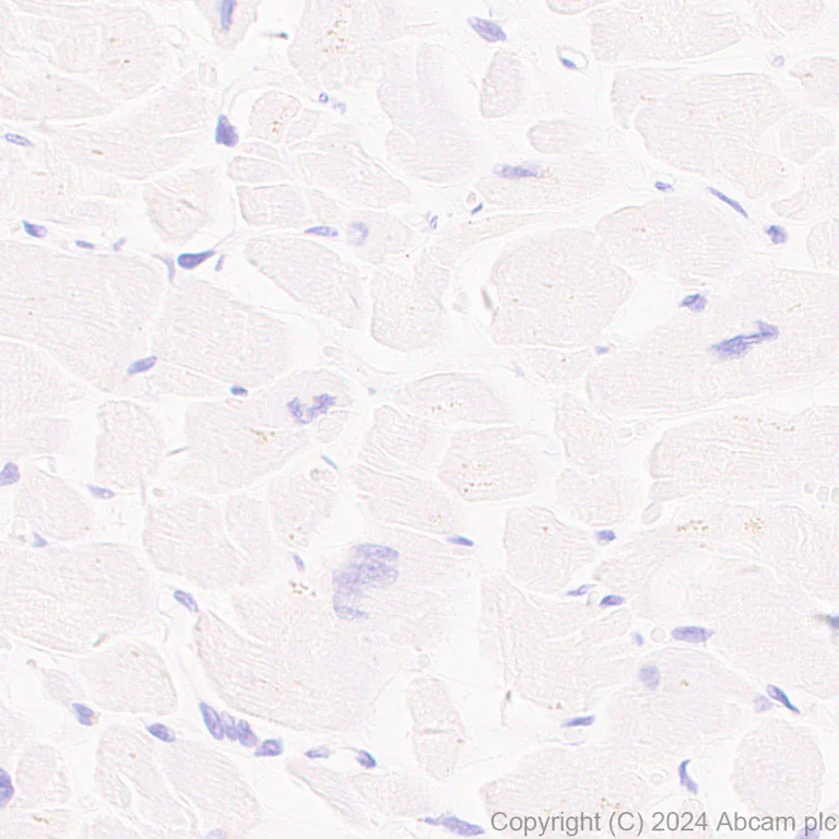 Immunohistochemistry (Formalin/PFA-fixed paraffin-embedded sections) - Anti-SCN11A antibody [EPR28603-86] (AB316326)