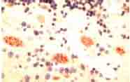 Immunohistochemistry (Formalin/PFA-fixed paraffin-embedded sections) - Anti-Scn1a antibody (AB24820), expandable thumbnail