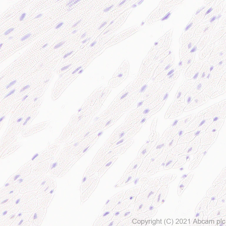 Immunohistochemistry (Formalin/PFA-fixed paraffin-embedded sections) - Anti-Scn1a antibody [EPR22326-112] - BSA and Azide free (AB281839)