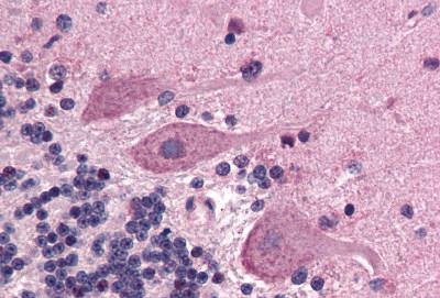 Immunohistochemistry (Formalin/PFA-fixed paraffin-embedded sections) - Anti-Scn1a antibody - N-terminal (AB140984)