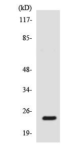 Western blot - Anti-Scn2b antibody (AB138064)
