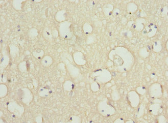 Immunohistochemistry (Formalin/PFA-fixed paraffin-embedded sections) - Anti-Scn2b antibody (AB230093)