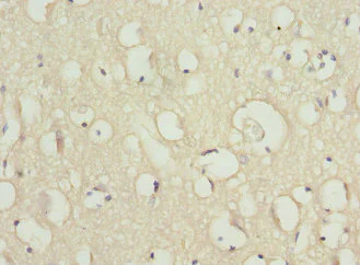 Immunohistochemistry (Formalin/PFA-fixed paraffin-embedded sections) - Anti-Scn2b antibody (AB230093)