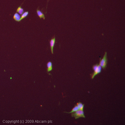 Immunocytochemistry/ Immunofluorescence - Anti-SCN3A antibody (AB65164), expandable thumbnail