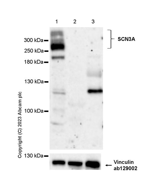 Western blot - Anti-SCN3A antibody [EPR25135-66] - BSA and Azide free (AB309474)