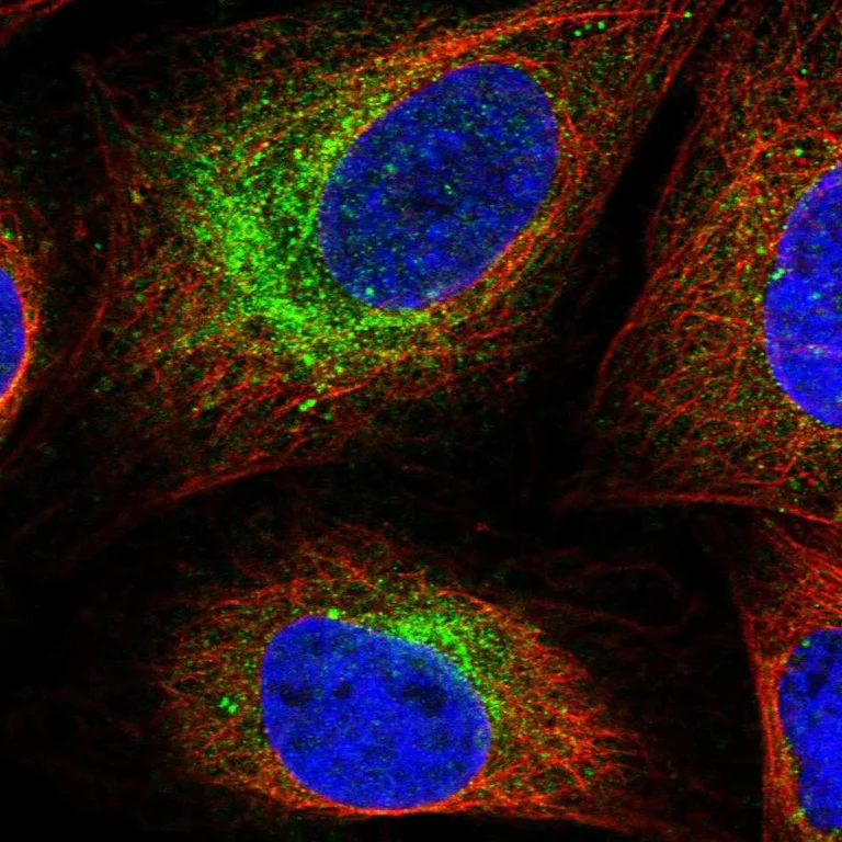 Immunocytochemistry/ Immunofluorescence - Anti-SCN3B antibody (AB254861)