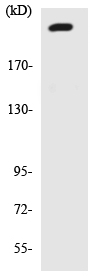 Western blot - Anti-SCN4A antibody (AB138079)