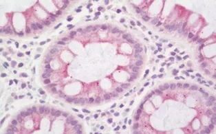 Immunohistochemistry (Formalin/PFA-fixed paraffin-embedded sections) - Anti-SCN4B antibody (AB219816)