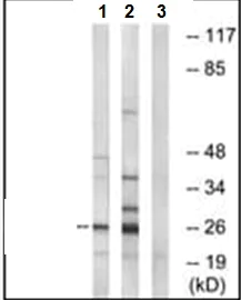 Western blot - Anti-SCN4B antibody (AB219816)