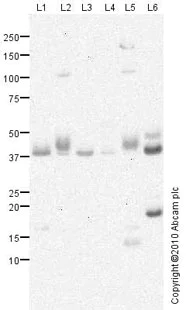 Western blot - Anti-SCN4B antibody (AB80539)