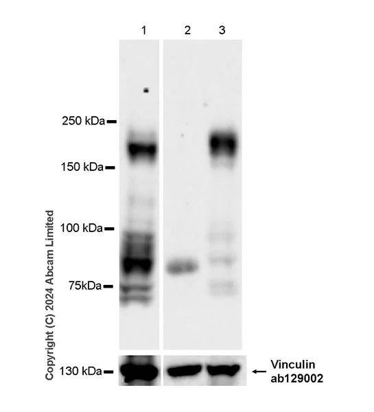 Western blot - Anti-SCN7A antibody [EPR27096-569] - BSA and Azide free (AB324823)