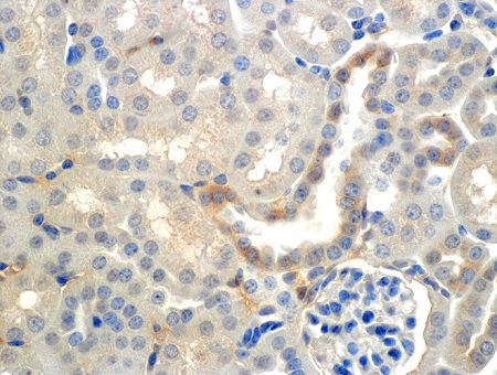 Immunohistochemistry (Formalin/PFA-fixed paraffin-embedded sections) - Anti-SCNN1B antibody [7B8] - C-terminal (AB241050)
