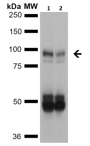 Western blot - Anti-SCNN1B antibody [7B8] - C-terminal (AB241050)