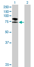 Western blot - Anti-SCNN1B antibody (AB172276)