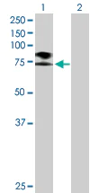 Western blot - Anti-SCNN1B antibody (AB172276)