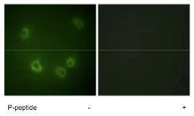 Immunocytochemistry/ Immunofluorescence - Anti-SCNN1B (phospho T615) antibody (AB79172)