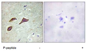 Immunohistochemistry (Formalin/PFA-fixed paraffin-embedded sections) - Anti-SCNN1B (phospho T615) antibody (AB79172)