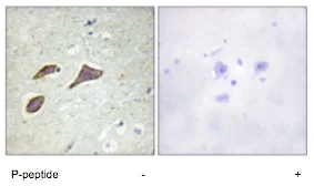 Immunohistochemistry (Formalin/PFA-fixed paraffin-embedded sections) - Anti-SCNN1B (phospho T615) antibody (AB79172)