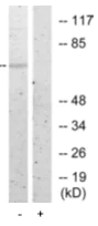 Western blot - Anti-SCNN1B (phospho T615) antibody (AB79172)
