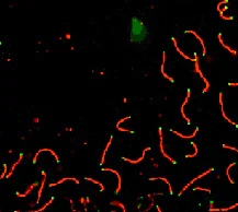 Immunocytochemistry/ Immunofluorescence - Anti-SCP1 antibody (AB15090)