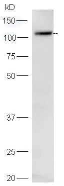 Western blot - Anti-SCP1 antibody (AB217295)