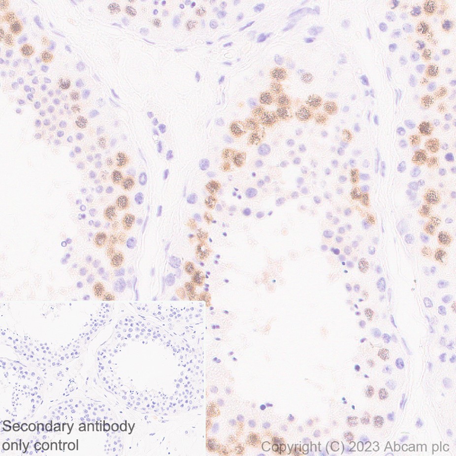 Immunohistochemistry (Formalin/PFA-fixed paraffin-embedded sections) - Anti-SCP1 antibody [EP7918] (AB175191), expandable thumbnail