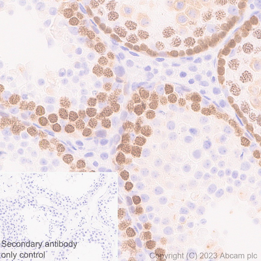 Immunohistochemistry (Formalin/PFA-fixed paraffin-embedded sections) - Anti-SCP1 antibody [EP7918] (AB175191), expandable thumbnail