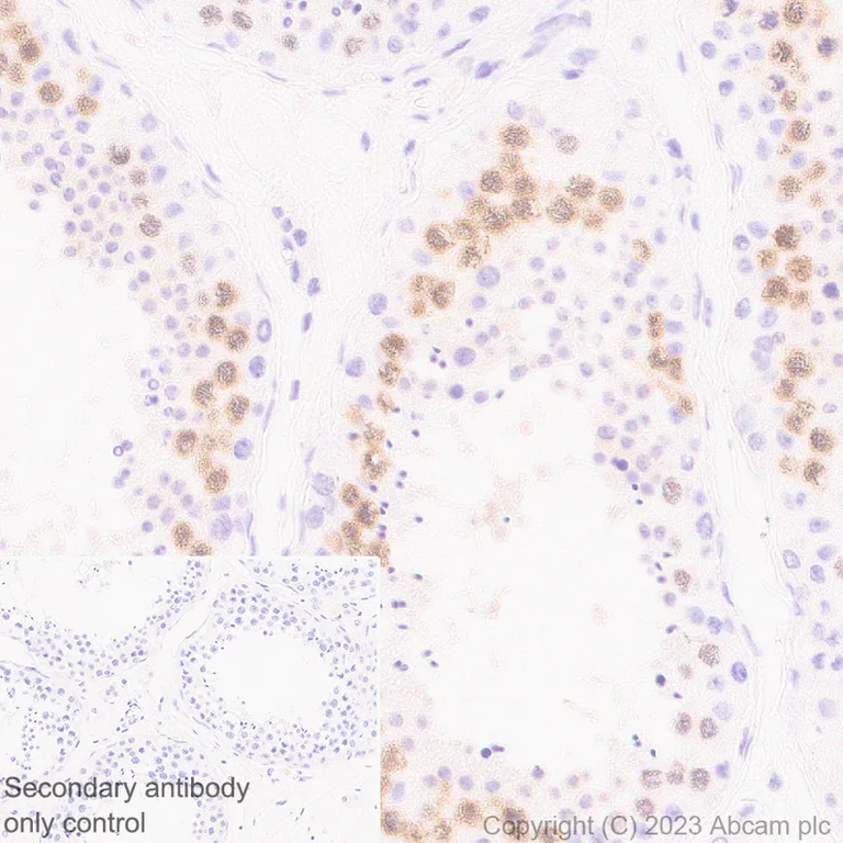 Immunohistochemistry (Formalin/PFA-fixed paraffin-embedded sections) - Anti-SCP1 antibody [EP7918] - BSA and Azide free (AB284826)