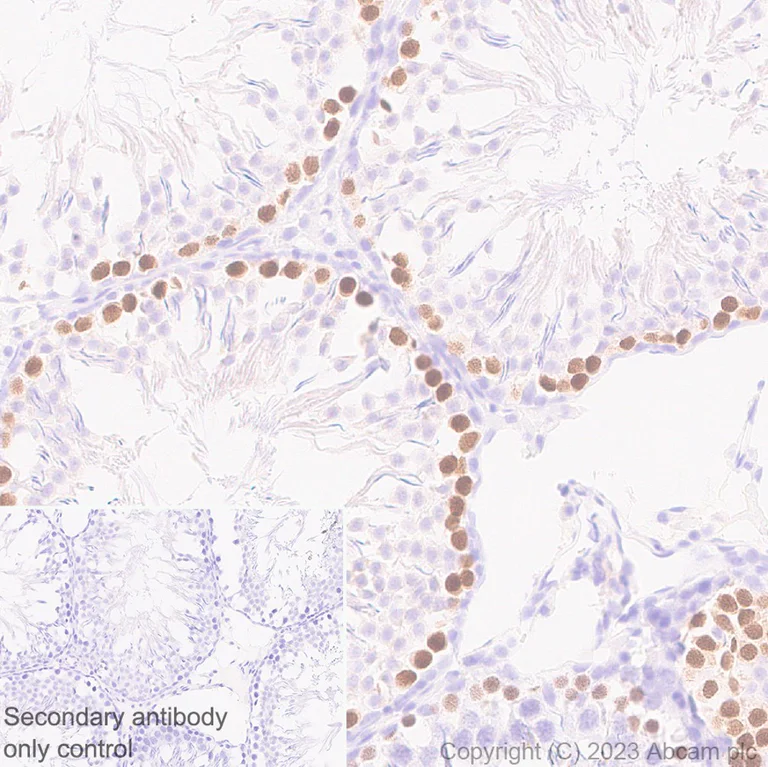 Immunohistochemistry (Formalin/PFA-fixed paraffin-embedded sections) - Anti-SCP1 antibody [EP7918] - BSA and Azide free (AB284826)