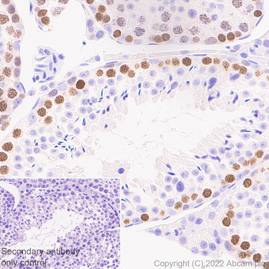Immunohistochemistry (Formalin/PFA-fixed paraffin-embedded sections) - Anti-SCP1 antibody [EPR27085-83] (ab303520), expandable thumbnail