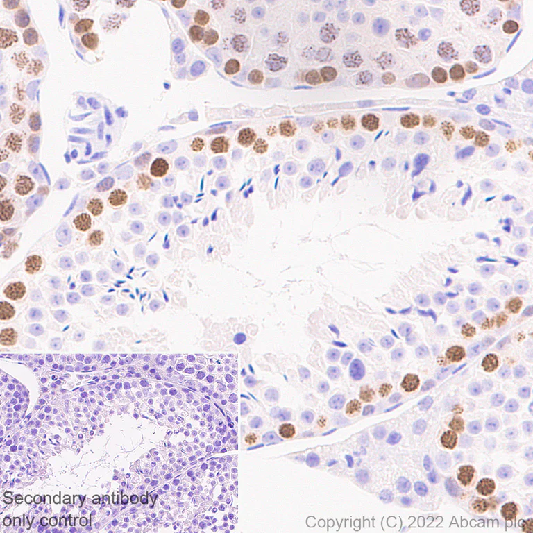 Immunohistochemistry (Formalin/PFA-fixed paraffin-embedded sections) - Anti-SCP1 antibody [EPR27085-83] (AB303520)
