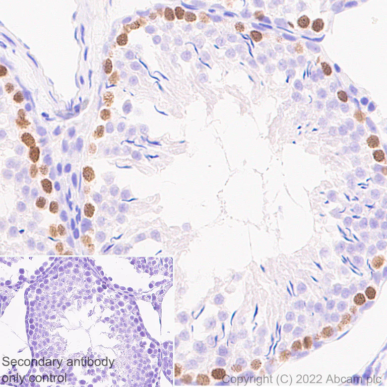 Immunohistochemistry (Formalin/PFA-fixed paraffin-embedded sections) - Anti-SCP1 antibody [EPR27085-83] (AB303520)