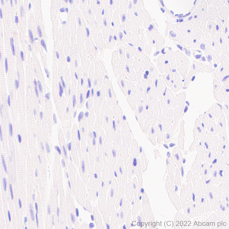 Immunohistochemistry (Formalin/PFA-fixed paraffin-embedded sections) - Anti-SCP1 antibody [EPR27085-83] (ab303520), expandable thumbnail